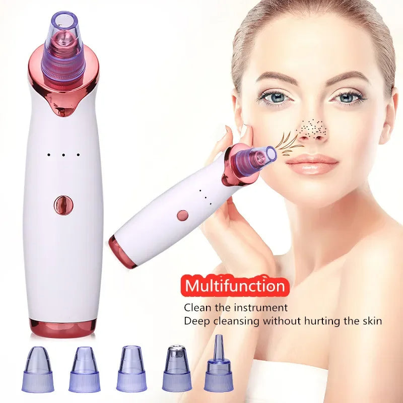 Aspirateur de points noirs
